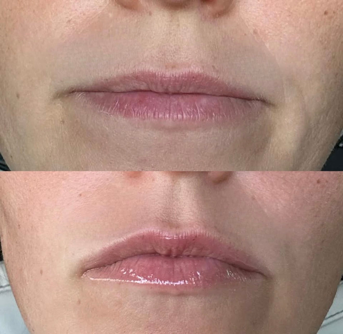 Peptide Pout - Raspberry